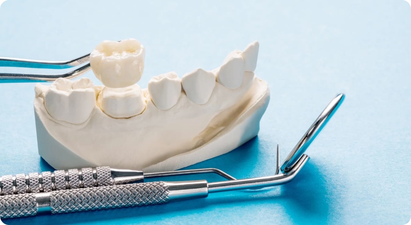 Read more about the article All-on-X with Zirconia Implants: Strength, Aesthetics, and Biocompatibility in One
